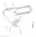 Fig. 04 - Sacroiliac joint fusion systems and methods