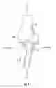 Fig. 02 - Orthopedic implant sizing instruments, systems, and methods
