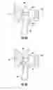 Fig. 07 - Orthopedic implant sizing instruments, systems, and methods
