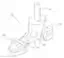 Fig. 01 - PROSTHETIC SPACER DEVICES, SYSTEMS, AND METHODS