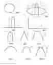 Fig. 03 - Stent retrieval member and devices and methods for retrieving or repositioning a stent