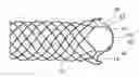 Fig. 01 - Integrated stent repositioning and retrieval loop