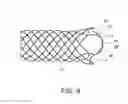 Fig. 05 - Integrated stent repositioning and retrieval loop