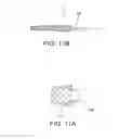 Fig. 08 - Integrated stent repositioning and retrieval loop