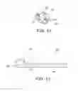 Fig. 09 - Integrated stent repositioning and retrieval loop