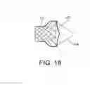 Fig. 12 - Integrated stent repositioning and retrieval loop