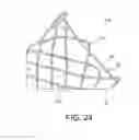 Fig. 16 - Integrated stent repositioning and retrieval loop