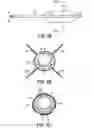 Fig. 04 - Process for loading a stent onto a stent delivery system