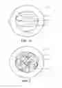 Fig. 03 - Temporary gastric device (TGD) and method of use