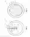 Fig. 05 - Temporary gastric device (TGD) and method of use