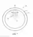 Fig. 06 - Temporary gastric device (TGD) and method of use