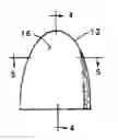 Fig. 01 - Semen neutralizing condom insert