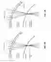 Fig. 05 - Wavefront correction for ophthalmic surgical lasers