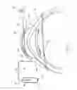 Fig. 02 - Corneal crosslinking with oxygenation