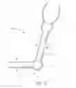 Fig. 14 - Ocular implant with therapeutic agents and methods thereof
