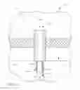 Fig. 25 - Ocular implant with therapeutic agents and methods thereof