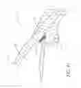 Fig. 26 - Ocular implant with therapeutic agents and methods thereof