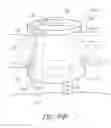 Fig. 33 - Ocular implant with therapeutic agents and methods thereof