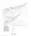 Fig. 35 - Ocular implant with therapeutic agents and methods thereof