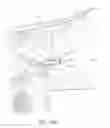Fig. 36 - Ocular implant with therapeutic agents and methods thereof