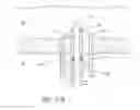 Fig. 42 - Ocular implant with therapeutic agents and methods thereof