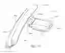 Fig. 51 - Ocular implant with therapeutic agents and methods thereof