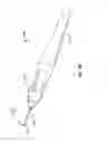 Fig. 04 - Ocular implant delivery systems and methods