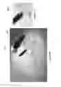 Fig. 10 - Ocular implant delivery systems and methods