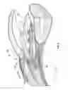 Fig. 15 - Ocular implant delivery systems and methods