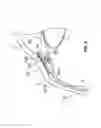 Fig. 16 - Ocular implant delivery systems and methods