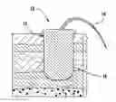Fig. 01 - Impregnable and Expanding Wound Packing Article