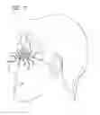 Fig. 08 - Tarsus eyelid patch