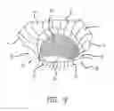 Fig. 10 - Tarsus eyelid patch
