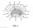 Fig. 12 - Tarsus eyelid patch