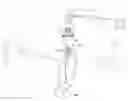 Fig. 01 - DEVICES AND METHODS FOR ACTIVE HEAD STABILIZATION DURING SURGERY