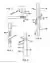 Fig. 05 - Weight Bearing Brace Device