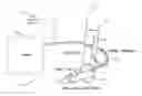 Fig. 01 - Systems and methods for multiple pulses for treatment of vascular conditions
