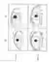 Fig. 02 - Method of enhancing hair growth