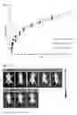 Fig. 06 - Composition containing polycationic triblock copolymer, polyanionic polymer and physiologically active peptide