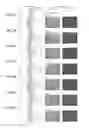 Fig. 05 - Liposomes Containing Oligopeptide Fragments of Myelin Basic Protein, a Pharmaceutical Composition and a Method for Treatment of Multiple Sclerosis