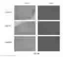 Fig. 10 - Liposomes Containing Oligopeptide Fragments of Myelin Basic Protein, a Pharmaceutical Composition and a Method for Treatment of Multiple Sclerosis