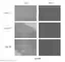 Fig. 11 - Liposomes Containing Oligopeptide Fragments of Myelin Basic Protein, a Pharmaceutical Composition and a Method for Treatment of Multiple Sclerosis