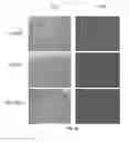 Fig. 12 - Liposomes Containing Oligopeptide Fragments of Myelin Basic Protein, a Pharmaceutical Composition and a Method for Treatment of Multiple Sclerosis