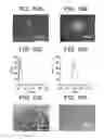 Fig. 11 - Yeast cell wall particles for receptor-targeted nanoparticle delivery