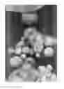Fig. 14 - Oxidized cellulose microspheres