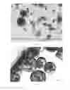 Fig. 16 - Oxidized cellulose microspheres