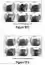 Fig. 16 - Molecular and Herbal Combinations for Treating Psoriasis