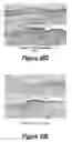 Fig. 21 - Molecular and Herbal Combinations for Treating Psoriasis