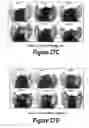 Fig. 16 - Molecular and Herbal Combinations for Treating Psoriasis
