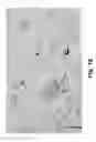 Fig. 17 - Composition for treating diabetes and dyslipidemia obtained from the extract of plant and a method of preparing the same